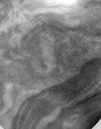 Fascia under magnification, fibers and layers