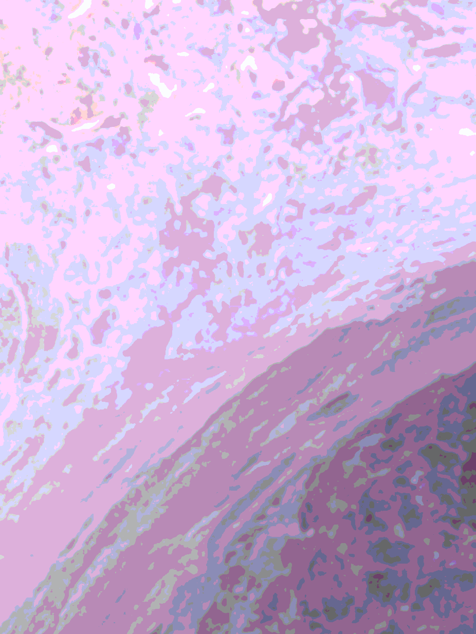 Photographic texture of human fascia connective tissue used for educational reference.